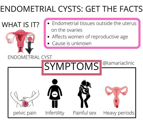 What Causes Cystic Endometrial Hyperplasia